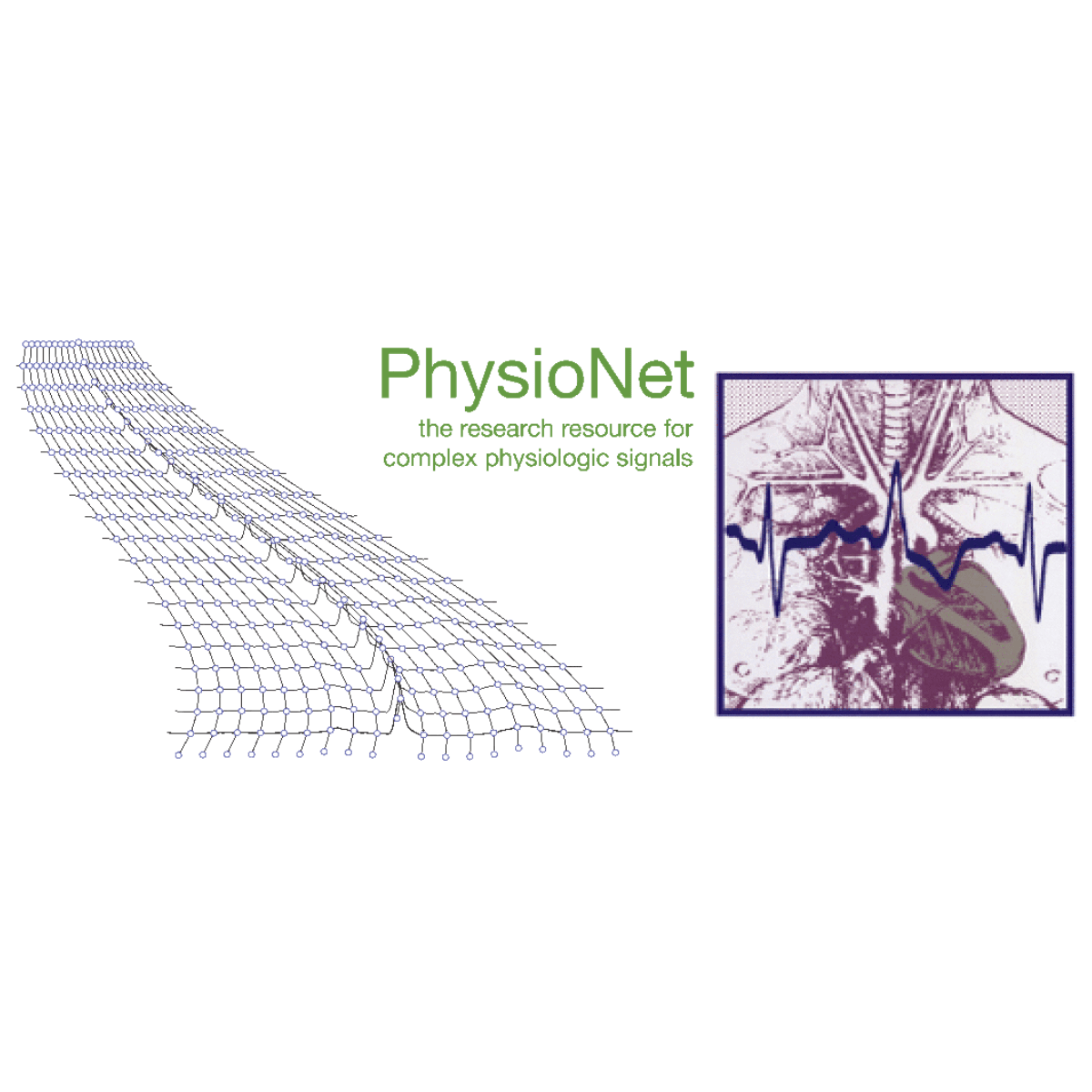 PhysioNet Challenge 2025